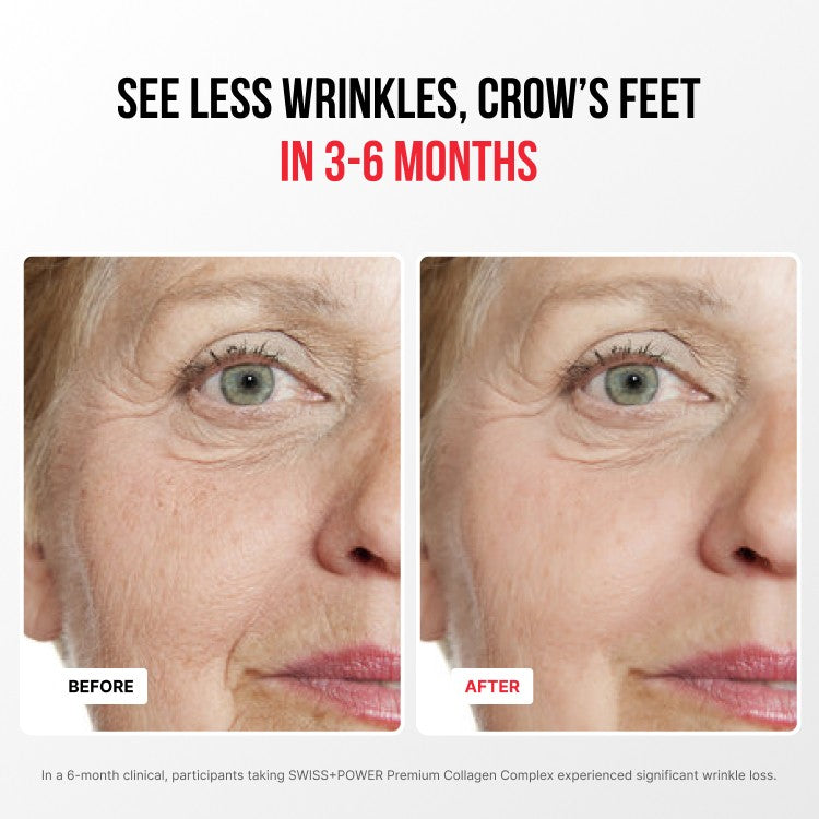 Complejo de Colágeno Premium