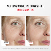 Complejo de Colágeno Premium