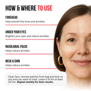 Parches de microagujas autodisolventes